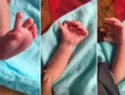 Padres con bebé de 26 dedos creen que se reencarnó en una diosa hindú