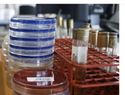 Nueva forma de eliminar bacterias resistentes a antibióticos