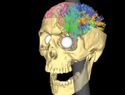 Tres lesiones cerebrales que cambiaron la ciencia de la mente