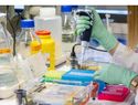 OMS alerta que el cáncer afectará a la mayoría de la población mundial
