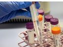 Desarrollan terapia génica para prevenir el alzhéimer