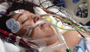 Ella estaba en coma, le pusieron el bebé en el pecho....
