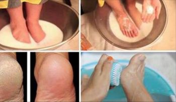 No botes más dinero en pedicura; conserva tus pies perfectos con estos dos ingredientes