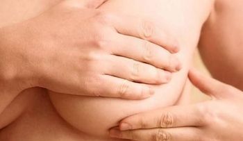 Cáncer de mama avanzado: una realidad diferente