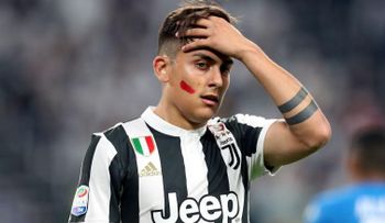 Estrellas del fútbol italiano usaron lápiz labial para esta campaña