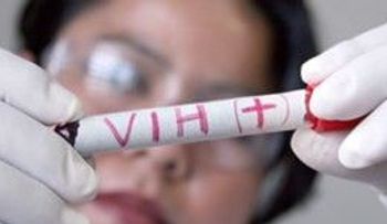 Cerca de 2,6 millones de personas se infectan cada año de sida, según informe