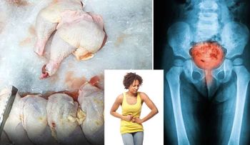 Este tipo de pollo está relacionado con la epidemia de infección del tracto urinario