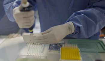 Se necesitan más estudios sobre transmisión de Zika
