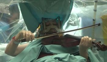 Video: Una mujer toca violín durante su cirugía de cerebro