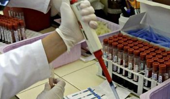 Laboratorista contagió por 10 años a pacientes con hepatitis C