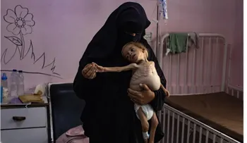 Gaza reporta cuatro muertos por desnutrición, incluidos dos mujeres y dos hombres