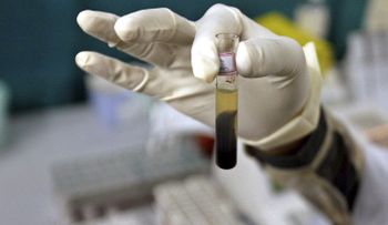 Descubren agentes que neutralizan al VIH