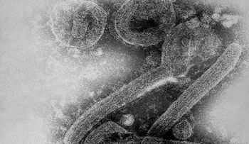 Marburgo, ¿el virus 'gemelo' del ébola?