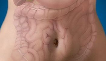  La enfermedad inflamatoria intestinal (EII): un dolor silencioso no curable