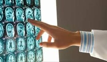  Un robot diagnostica tumores cerebrales con más certeza que 15 médicos