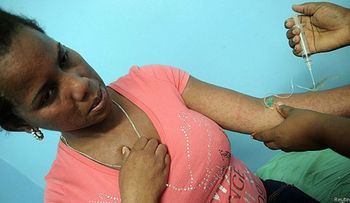 BBC: Cómo se vive el chikungunya en Venezuela