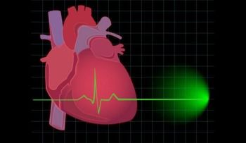 5 actividades que pueden provocar un infarto y no conocías