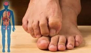 Lo que tus pies revelan sobre tu higado dañado 