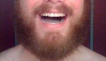 Algunas barbas de hombres tienen más materia fecal que un baño