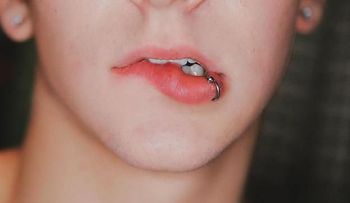 Los piercings pueden provocar inflamación, hemorragias, infecciones y otros problemas en dientes y encías
