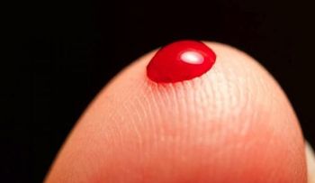 Niños con hemofilia aprenden a conocer su condición y prevenir complicaciones