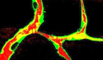El colesterol alto fomenta el crecimiento del cáncer de mama
