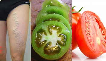 ASOMBROSO! Con la ayuda de un tomate se puede curar las venas varicosas