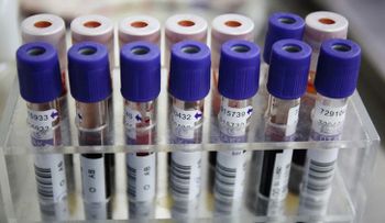 Una empresa de EE.UU. busca ganarle la carrera al cáncer con pruebas rápidas de ADN
