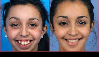 Jovencita luce impresionante tras varias cirugias (VIDEO)