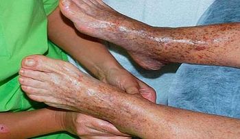 En solo 10 minutos resuelve el problema de circulación