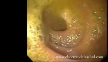 ¡Cuidado! si comes estos alimentos podrías contraer gusanos cerebrales (VIDEO)