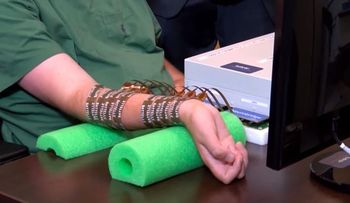 Crean un dispositivo para mover los miembros paralizados con el pensamiento