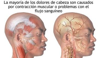 ¿Como solucionar, el dolor de cabeza constante?