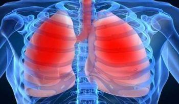 La hipertensión pulmonar, una enfermedad grave, rara y de difícil diagnóstico