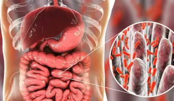 Hallan diferencias en la microbiota intestinal de las personas con depresión