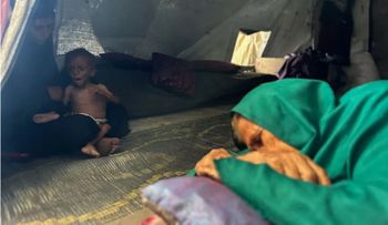 Amnistía denuncia política deliberada de hambre en Gaza