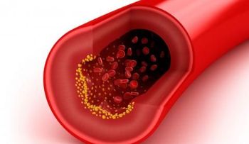 El colesterol bueno o HDL en la sangre no siempre es saludable para el corazón
