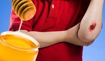 Poner miel a las heridas ayuda a curarlas más rápido y detiene el crecimiento de bacterias  
