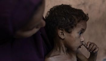 Desnutrición acaba con la vida de cinco gazatíes, entre ellos un bebé y dos niños, en 24 horas