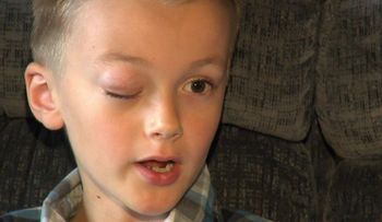 Niño que donó cabello para sobrevivientes de cáncer ahora tiene la misma enfermedad