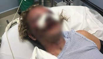 Embajada de EEUU sigue de cerca caso de turista agredida en hotel de Punta Cana