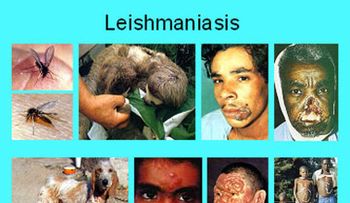 Leishmaniasis: una enfermedad infecciosa que afecta cerca de tres millones de personas