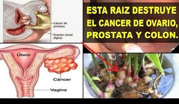 Esta poderosa raíz destruye el cáncer de próstata, ovarios y colon (VIDEO)