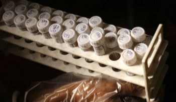 Cóctel mortal: los contagios del VIH se disparan antes de las guerras