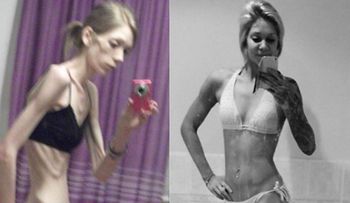 Nicola King, la joven anoréxica que se convirtió en campeona de fisicoculturismo