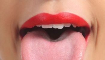 Tenía una capa blanca sobre su lengua, pero por suerte fue al médico justo a tiempo 