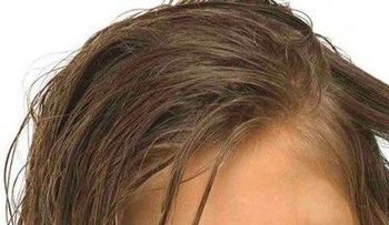 Remedios para los piojos: Mayonesa y vinagre, enjuague bucal y un champú natural