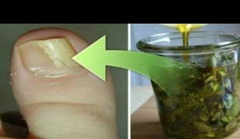 Con unas gotitas de orégano al día, y los hongos de tus uñas se secarán por completos