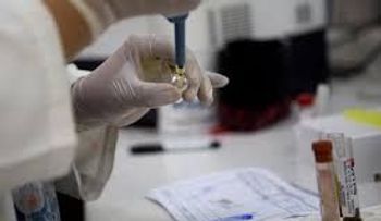 Texas confirma transmisión local del virus del Zika