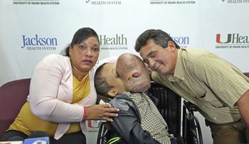 IMAGENES SENSIBLES: Extirparán en Miami un tumor de 4,5 kilos del rostro de un niño cubano